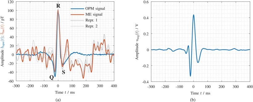 Thumbnail for Investigation of Converse Magnetoelectric Thin-Film Sensors for Magnetocardiography